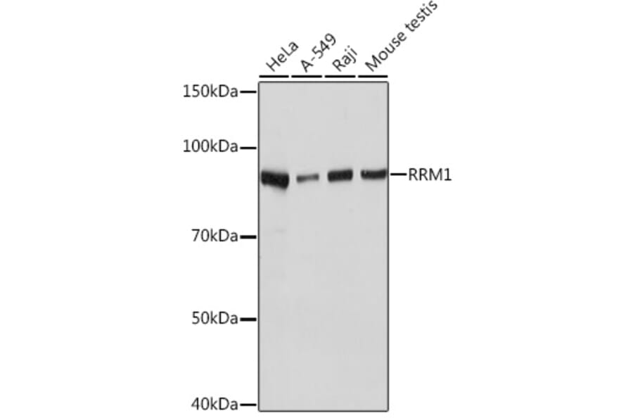 Western Blot - Anti-RRM1 Antibody [ARC0943] (A309074) - Antibodies.com