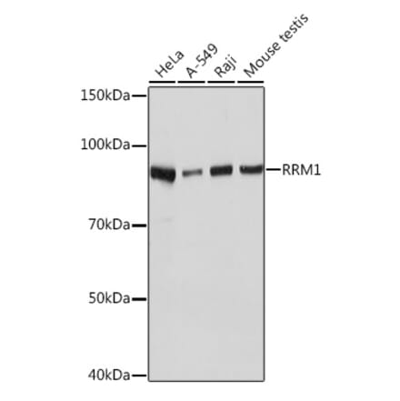 Western Blot - Anti-RRM1 Antibody [ARC0943] (A309074) - Antibodies.com