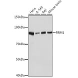 Western Blot - Anti-RRM1 Antibody [ARC0943] (A309074) - Antibodies.com