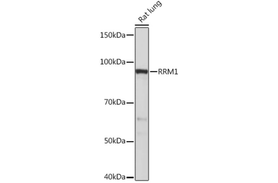 Western Blot - Anti-RRM1 Antibody [ARC0943] (A309074) - Antibodies.com