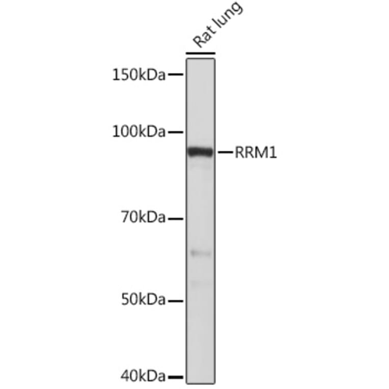 Western Blot - Anti-RRM1 Antibody [ARC0943] (A309074) - Antibodies.com