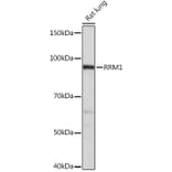 Western Blot - Anti-RRM1 Antibody [ARC0943] (A309074) - Antibodies.com