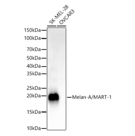 Western Blot - Anti-Melanoma Antibody [ARC55924] (A309075) - Antibodies.com