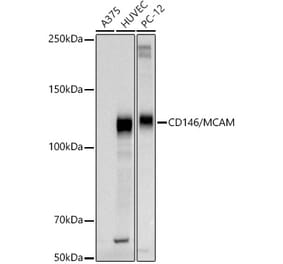Western Blot - Anti-CD146 Antibody (A309076) - Antibodies.com