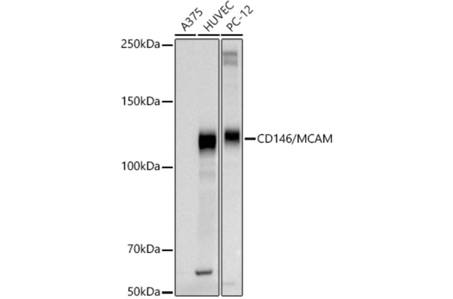 Western Blot - Anti-CD146 Antibody (A309076) - Antibodies.com