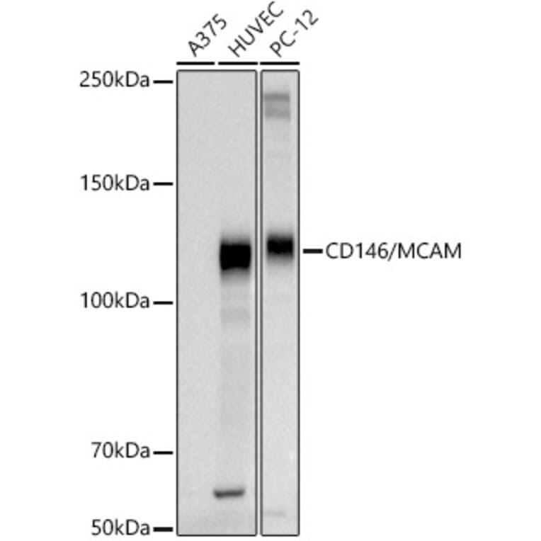 Western Blot - Anti-CD146 Antibody (A309076) - Antibodies.com