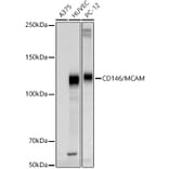 Western Blot - Anti-CD146 Antibody (A309076) - Antibodies.com