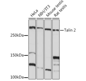 Western Blot - Anti-Talin 2 Antibody [ARC2335] (A309077) - Antibodies.com