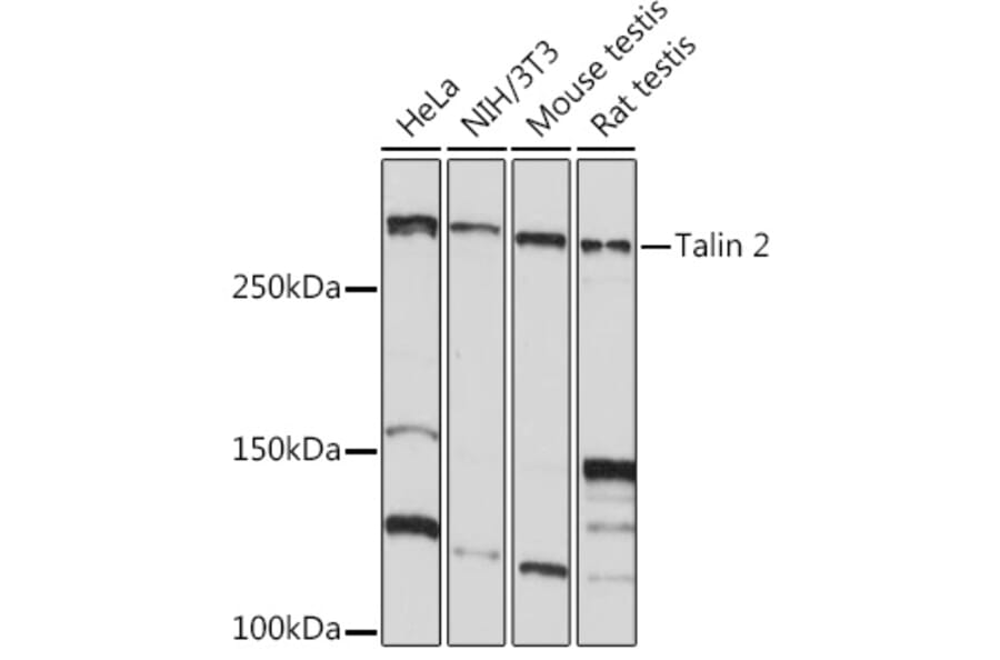 Western Blot - Anti-Talin 2 Antibody [ARC2335] (A309077) - Antibodies.com