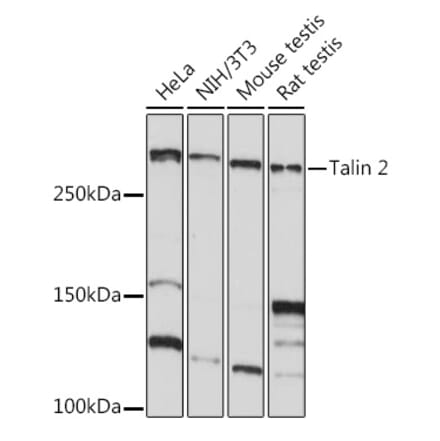 Western Blot - Anti-Talin 2 Antibody [ARC2335] (A309077) - Antibodies.com