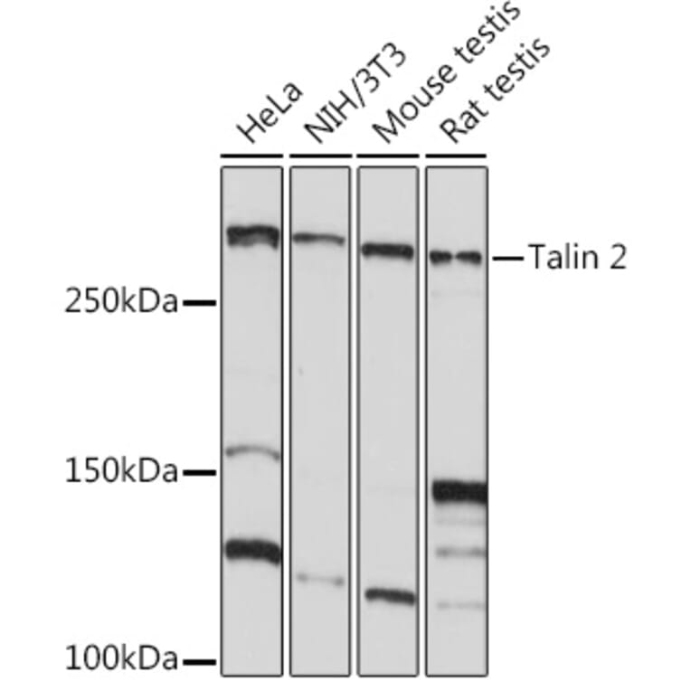 Western Blot - Anti-Talin 2 Antibody [ARC2335] (A309077) - Antibodies.com