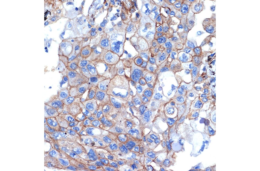 Immunohistochemistry - Anti-Talin 2 Antibody [ARC2335] (A309077) - Antibodies.com