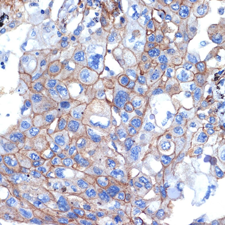 Immunohistochemistry - Anti-Talin 2 Antibody [ARC2335] (A309077) - Antibodies.com