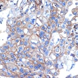 Immunohistochemistry - Anti-Talin 2 Antibody [ARC2335] (A309077) - Antibodies.com