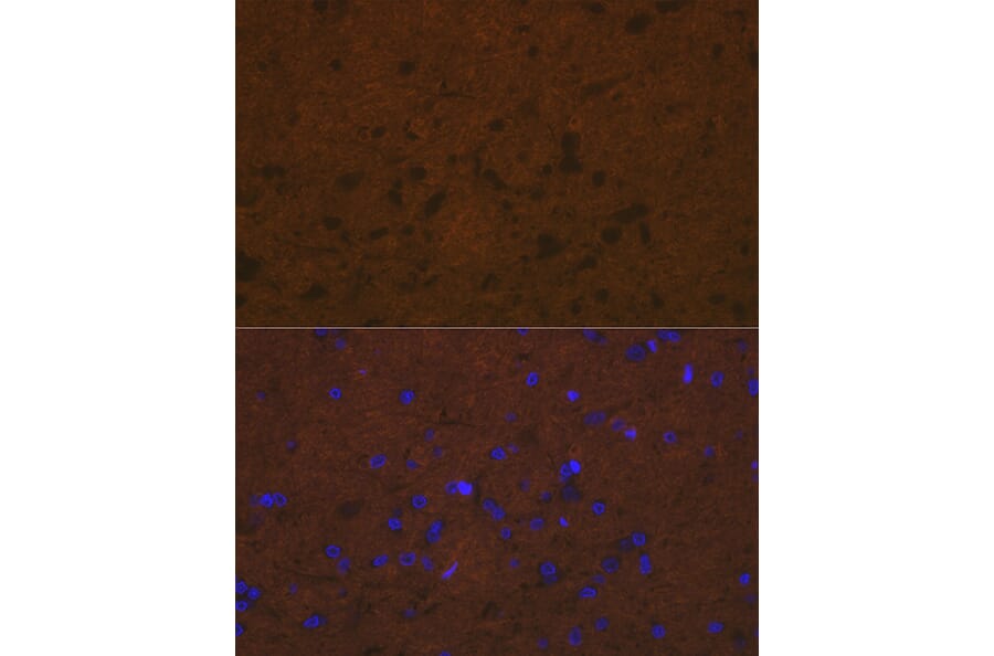Immunofluorescence - Anti-Talin 2 Antibody [ARC2335] (A309077) - Antibodies.com
