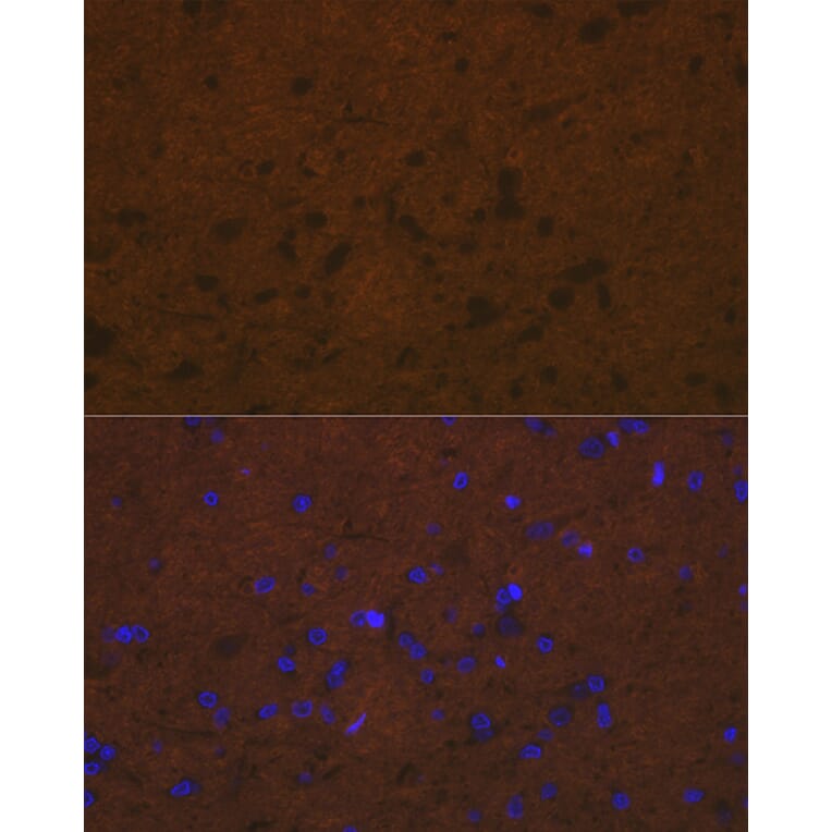 Immunofluorescence - Anti-Talin 2 Antibody [ARC2335] (A309077) - Antibodies.com