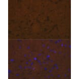 Immunofluorescence - Anti-Talin 2 Antibody [ARC2335] (A309077) - Antibodies.com