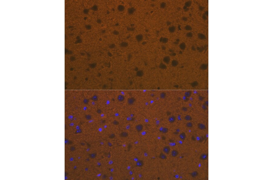 Immunofluorescence - Anti-Talin 2 Antibody [ARC2335] (A309077) - Antibodies.com