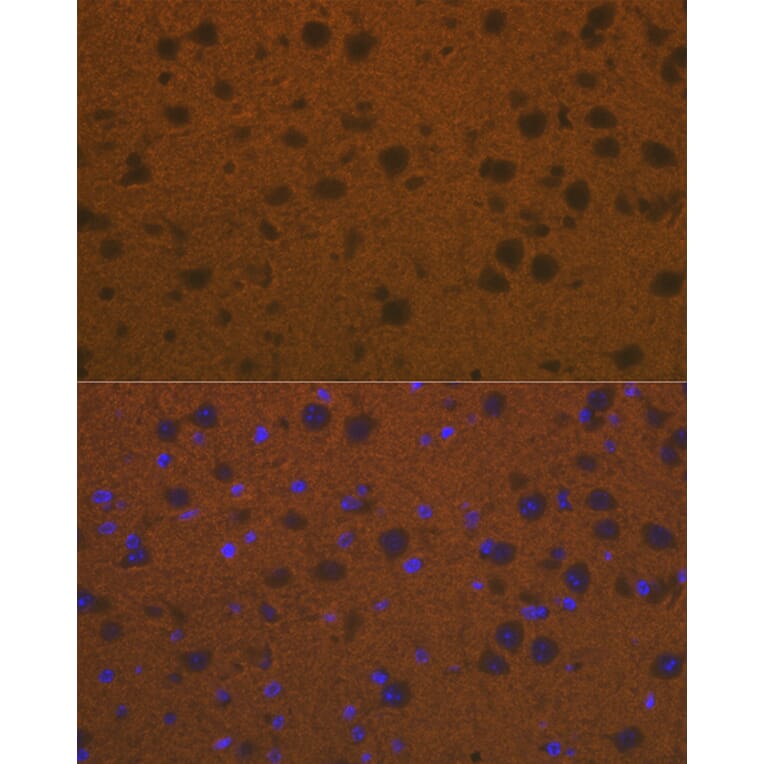 Immunofluorescence - Anti-Talin 2 Antibody [ARC2335] (A309077) - Antibodies.com