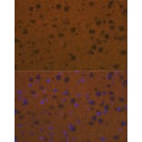 Immunofluorescence - Anti-Talin 2 Antibody [ARC2335] (A309077) - Antibodies.com