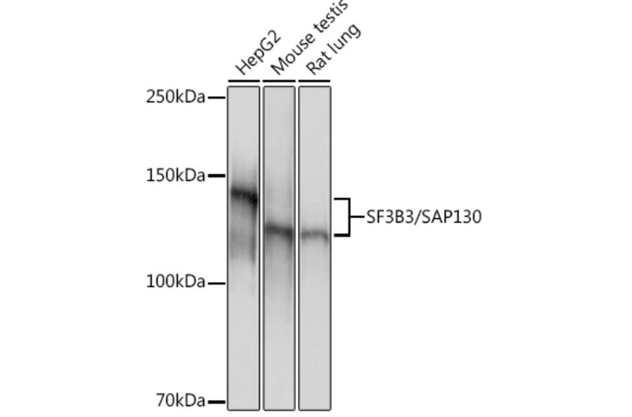 Western Blot - Anti-SF3B3 Antibody [ARC1667] (A309080) - Antibodies.com