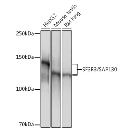Western Blot - Anti-SF3B3 Antibody [ARC1667] (A309080) - Antibodies.com
