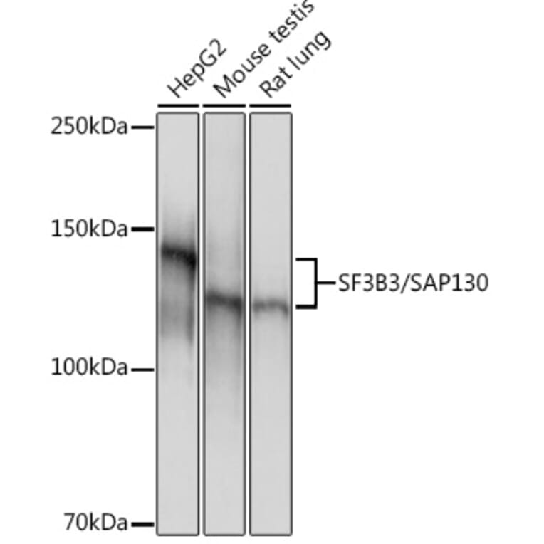 Western Blot - Anti-SF3B3 Antibody [ARC1667] (A309080) - Antibodies.com