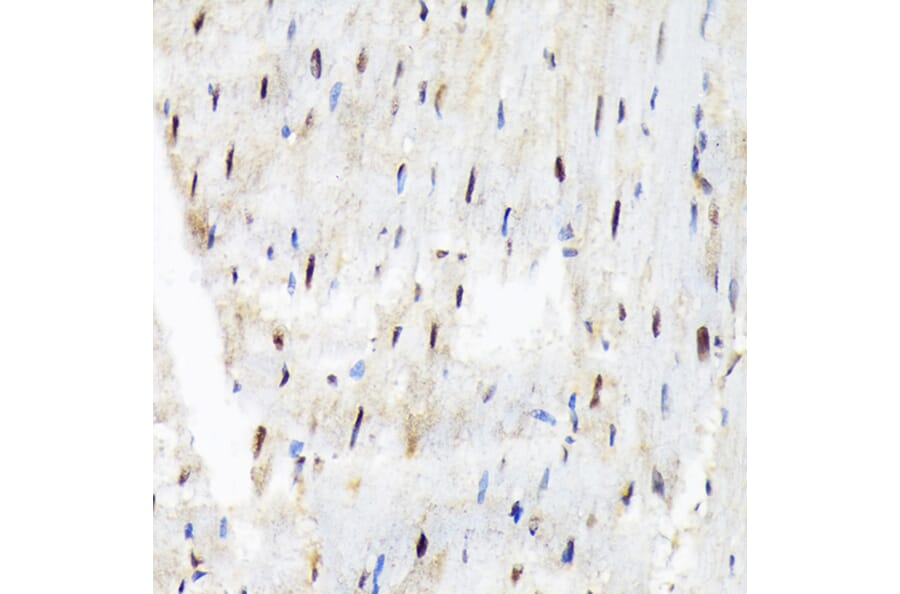 Immunohistochemistry - Anti-SF3B3 Antibody [ARC1667] (A309080) - Antibodies.com