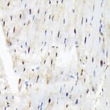 Immunohistochemistry - Anti-SF3B3 Antibody [ARC1667] (A309080) - Antibodies.com