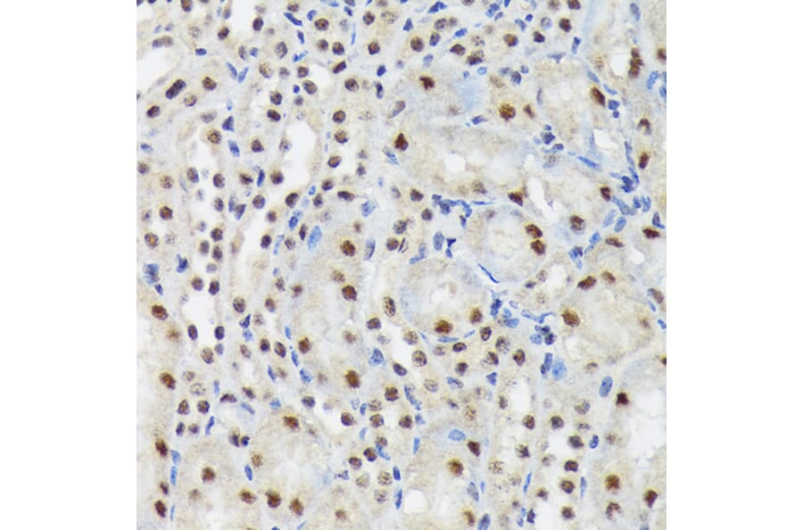 Immunohistochemistry - Anti-SF3B3 Antibody [ARC1667] (A309080) - Antibodies.com