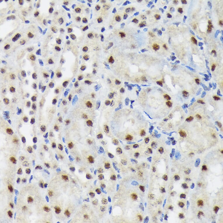 Immunohistochemistry - Anti-SF3B3 Antibody [ARC1667] (A309080) - Antibodies.com