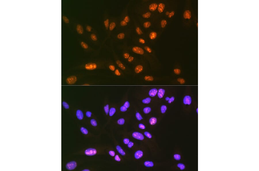 Immunofluorescence - Anti-SF3B3 Antibody [ARC1667] (A309080) - Antibodies.com