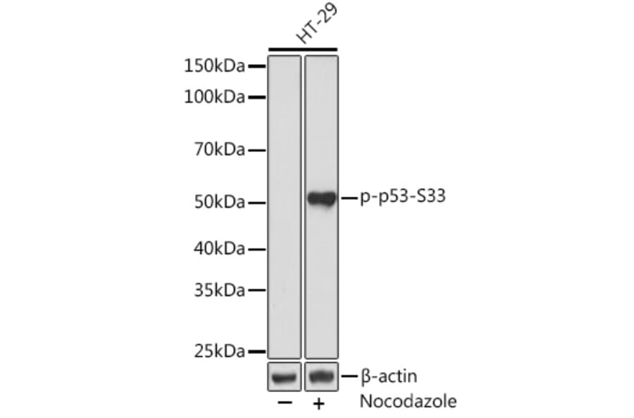 Western Blot - Anti-p53 (phospho Ser33) Antibody [ARC1528] (A309081) - Antibodies.com