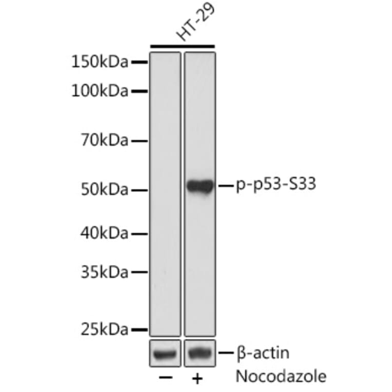 Western Blot - Anti-p53 (phospho Ser33) Antibody [ARC1528] (A309081) - Antibodies.com
