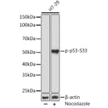 Western Blot - Anti-p53 (phospho Ser33) Antibody [ARC1528] (A309081) - Antibodies.com