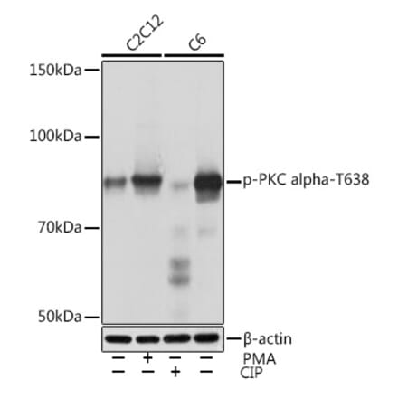 Western Blot - Anti-PKC alpha (phospho Thr638) Antibody [ARC1591] (A309082) - Antibodies.com