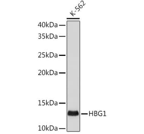 Western Blot - Anti-fetal hemoglobin Antibody [ARC1837] (A309083) - Antibodies.com