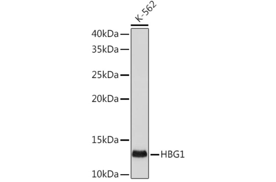 Western Blot - Anti-Fetal Hemoglobin Antibody [ARC1837] (A309083) - Antibodies.com