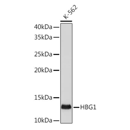 Western Blot - Anti-fetal hemoglobin Antibody [ARC1837] (A309083) - Antibodies.com