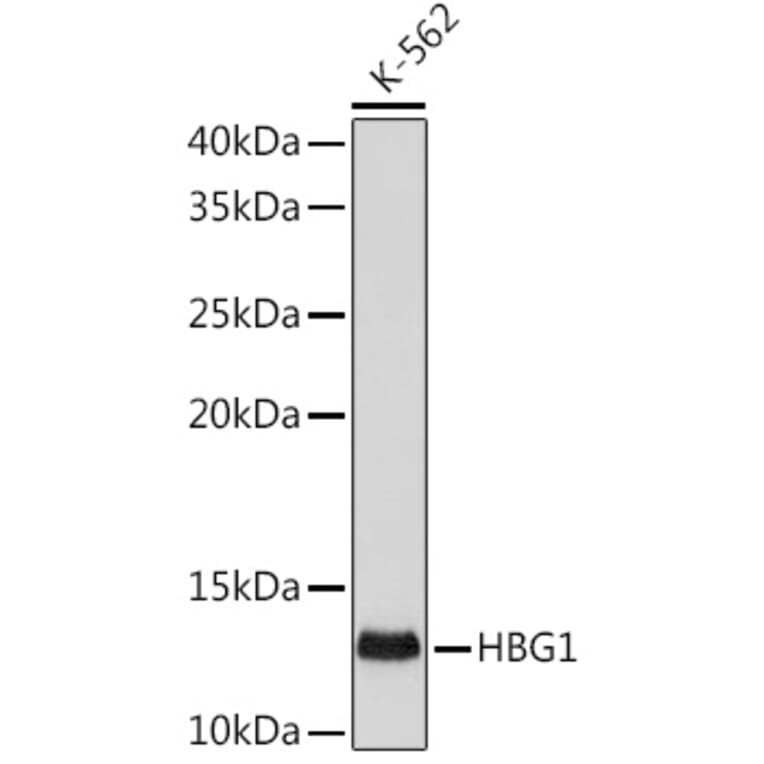 Western Blot - Anti-Fetal Hemoglobin Antibody [ARC1837] (A309083) - Antibodies.com