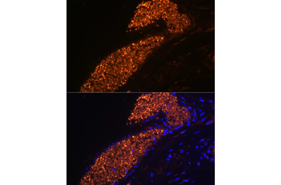 Immunofluorescence - Anti-Fetal Hemoglobin Antibody [ARC1837] (A309083) - Antibodies.com