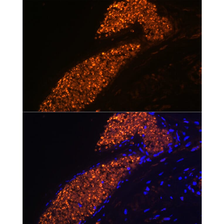 Immunofluorescence - Anti-Fetal Hemoglobin Antibody [ARC1837] (A309083) - Antibodies.com