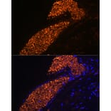 Immunofluorescence - Anti-Fetal Hemoglobin Antibody [ARC1837] (A309083) - Antibodies.com
