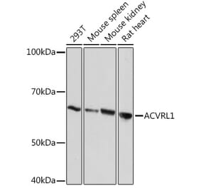 Western Blot - Anti-ALK-1 Antibody [ARC1735] (A309084) - Antibodies.com
