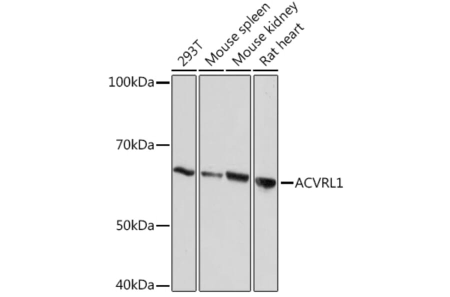 Western Blot - Anti-ALK-1 Antibody [ARC1735] (A309084) - Antibodies.com
