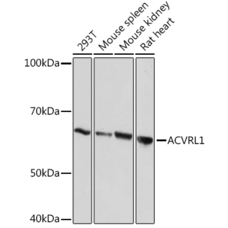 Western Blot - Anti-ALK-1 Antibody [ARC1735] (A309084) - Antibodies.com