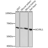 Western Blot - Anti-ALK-1 Antibody [ARC1735] (A309084) - Antibodies.com
