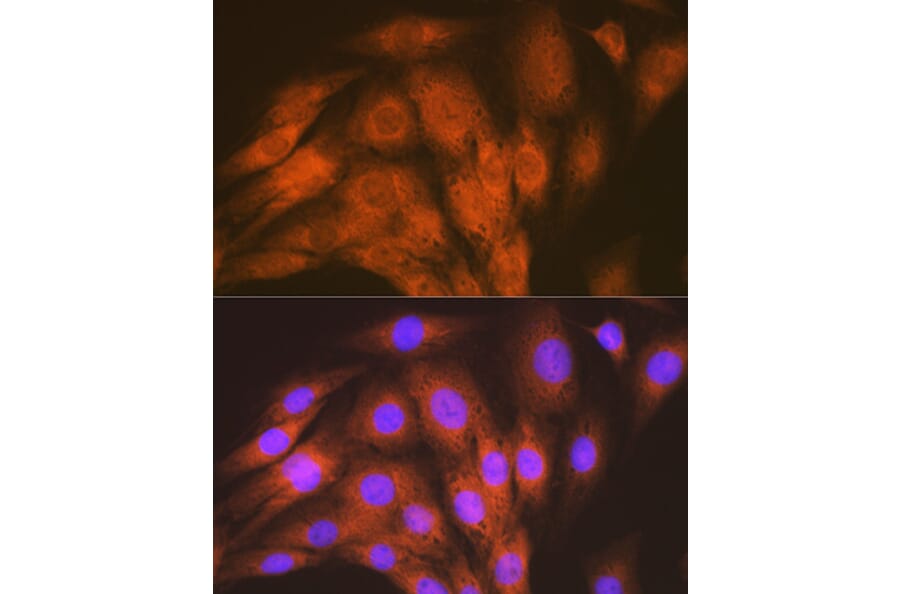 Immunofluorescence - Anti-ALK-1 Antibody [ARC1735] (A309084) - Antibodies.com