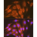Immunofluorescence - Anti-ALK-1 Antibody [ARC1735] (A309084) - Antibodies.com