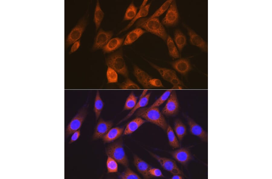 Immunofluorescence - Anti-ALK-1 Antibody [ARC1735] (A309084) - Antibodies.com